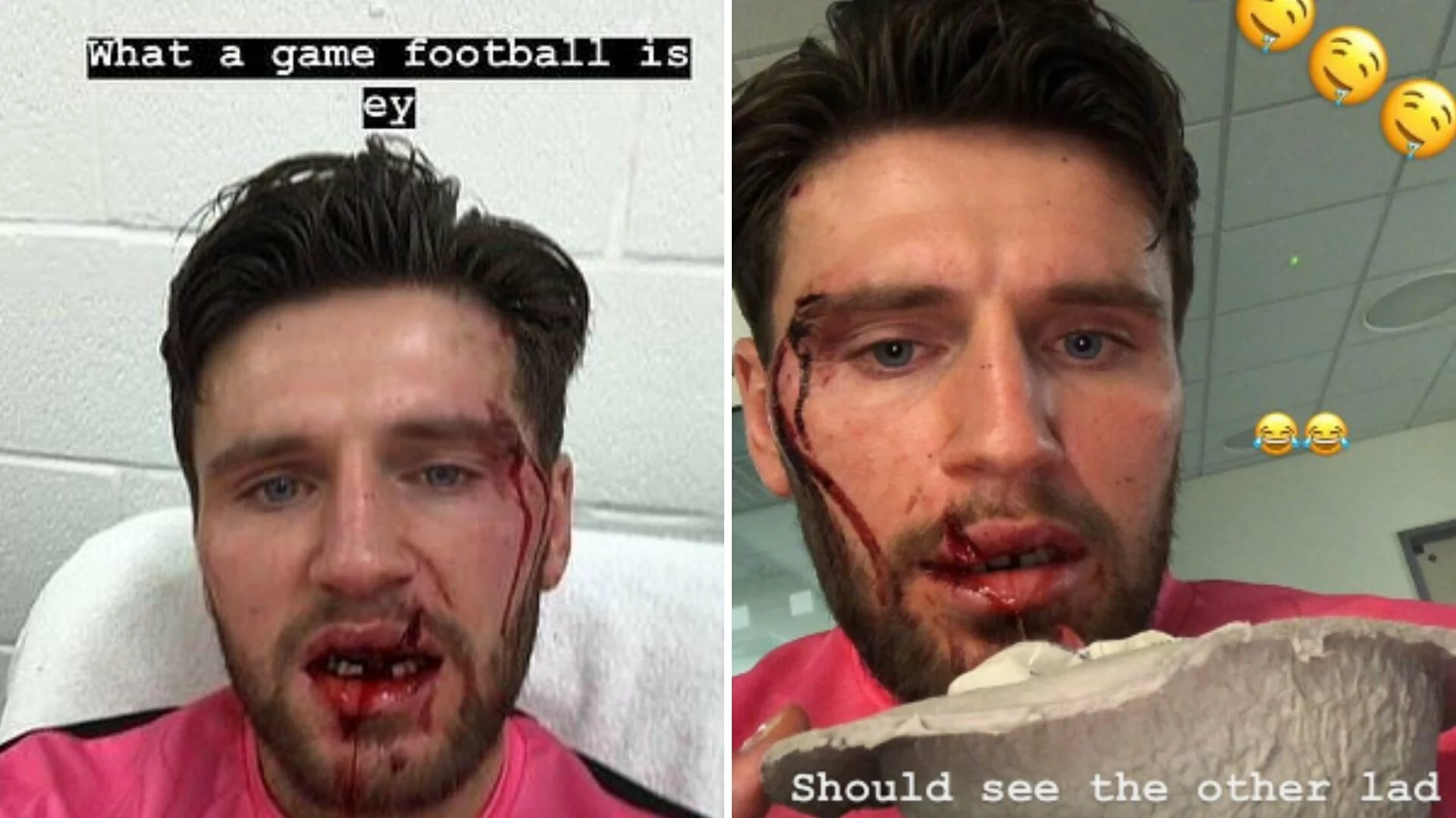 Forest Green Goalkeeper Loses Teeth And Suffers 'Horrendous Cut' - FootyNews.co.uk